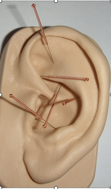 nadapunkter-i-gummioere