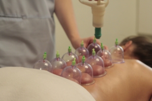 Cupping-300x200-1